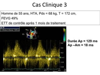 Cas Clinique 3 Homme de 55 ans, HTA,  Pds = 68 kg, T = 172 cm,  FEVG 49% ETT de contrôle après 1 mois de traitement Durée Ap = 129 ms Ap –Am = 18 ms 