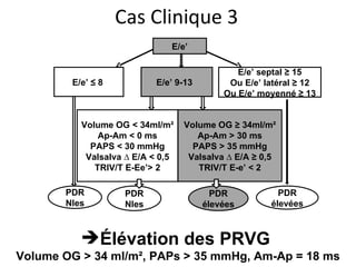E/e’ E/e’ ≤ 8  E/e’ 9-13  E/e’ septal ≥ 15 Ou E/e’ latéral ≥ 12 Ou E/e’ moyenné ≥ 13 Volume OG < 34ml/m² Ap-Am < 0 ms PAPS < 30 mmHg Valsalva ∆ E/A < 0,5 TRIV/T E-Ee’> 2 Volume OG ≥ 34ml/m² Ap-Am > 30 ms PAPS > 35 mmHg Valsalva ∆ E/A ≥ 0,5 TRIV/T E-e’ < 2 PDR Nles PDR élevées PDR Nles PDR élevées Cas Clinique 3 Élévation des PRVG  Volume OG > 34 ml/m², PAPs > 35 mmHg, Am-Ap = 18 ms 