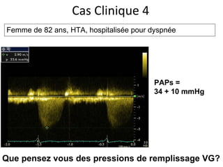 Cas Clinique 4 Femme de 82 ans, HTA, hospitalisée pour dyspnée PAPs =  34 + 10 mmHg Que pensez vous des pressions de remplissage VG? 