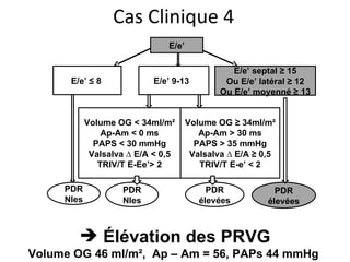 E/e’ E/e’ ≤ 8  E/e’ 9-13  E/e’ septal ≥ 15 Ou E/e’ latéral ≥ 12 Ou E/e’ moyenné ≥ 13 Volume OG < 34ml/m² Ap-Am < 0 ms PAPS < 30 mmHg Valsalva ∆ E/A < 0,5 TRIV/T E-Ee’> 2 Volume OG ≥ 34ml/m² Ap-Am > 30 ms PAPS > 35 mmHg Valsalva ∆ E/A ≥ 0,5 TRIV/T E-e’ < 2 PDR Nles PDR élevées PDR Nles PDR élevées Cas Clinique 4 Élévation des PRVG Volume OG 46 ml/m²,  Ap – Am = 56, PAPs 44 mmHg  