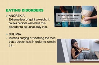 EATING DISORDERS
⮚ ANOREXIA
- Extreme fear of gaining weight; it
causes persons who have this
disorder to be unnaturally thin.
⮚ BULIMIA
- Involves purging or vomiting the food
that a person eats in order to remain
thin.
 
