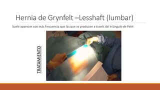 Hernia de Grynfelt –Lesshaft (lumbar)
Suele aparecer con más frecuencia que las que se producen a través del triángulo de Petit
TRATAMIENTO
 