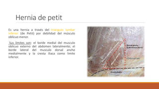 Hernia de petit
Es una hernia a través del triangulo lumbar
inferior (de Petit) por debilidad del músculo
oblicuo menor.
Sus límites son: el borde medial del musculo
oblicuo externo del abdomen lateralmente; el
borde lateral del musculo dorsal ancho
medialmente y la cresta iliaca como limite
inferior.
 