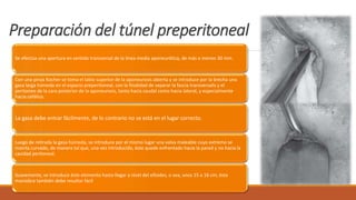 Preparación del túnel preperitoneal
Se efectúa una apertura en sentido transversal de la línea media aponeurótica, de más o menos 30 mm.
Con una pinza Kocher se toma el labio superior de la aponeurosis abierta y se introduce por la brecha una
gasa larga húmeda en el espacio preperitoneal, con la finalidad de separar la fascia transversalis y el
peritoneo de la cara posterior de la aponeurosis, tanto hacia caudal como hacia lateral, y especialmente
hacia cefálico.
La gasa debe entrar fácilmente, de lo contrario no se está en el lugar correcto.
Luego de retirada la gasa húmeda, se introduce por el mismo lugar una valva maleable cuyo extremo se
inserta curvado, de manera tal que, una vez introducido, éste quede enfrentado hacia la pared y no hacia la
cavidad peritoneal.
Suavemente, se introduce éste elemento hasta llegar a nivel del xifoides, o sea, unos 15 a 16 cm; ésta
maniobra también debe resultar fácil
 