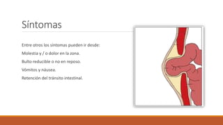 Síntomas
Entre otros los síntomas pueden ir desde:
Molestia y / o dolor en la zona.
Bulto reducible o no en reposo.
Vómitos y náusea.
Retención del tránsito intestinal.
 