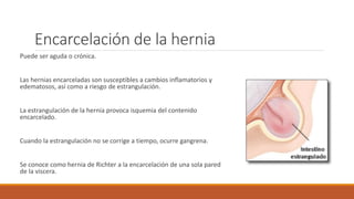 Encarcelación de la hernia
Puede ser aguda o crónica.
Las hernias encarceladas son susceptibles a cambios inflamatorios y
edematosos, así como a riesgo de estrangulación.
La estrangulación de la hernia provoca isquemia del contenido
encarcelado.
Cuando la estrangulación no se corrige a tiempo, ocurre gangrena.
Se conoce como hernia de Richter a la encarcelación de una sola pared
de la viscera.
 