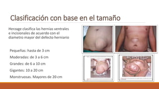 Herzage clasifica las hernias ventrales
e incisionales de acuerdo con el
diametro mayor del defecto herniario
Pequeñas: hasta de 3 cm
Moderadas: de 3 a 6 cm
Grandes: de 6 a 10 cm
Gigantes: 10 a 20 cm
Monstruosas. Mayores de 20 cm
 