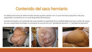 Un defecto herniario de determinado tamaño puede coexistir con un saco herniario pequeño o de poca
capacidad o convertirse en un saco de grandes dimensiones
Cuando el tamaño y el contenido del saco exceden la capacidad de la cavidad abdominal para recibir de nuevo
las asas intestinales herniadas se convierte en una hernia con “perdida de dominio” o “perdida de domicilio”
 
