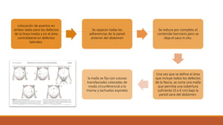 colocación de puertos en
ambos lados para los defectos
de la línea media y en el área
contralateral en defectos
laterales.
Se separan todas las
adherencias de la pared
anterior del abdomen
Se reduce por completo el
contenido herniario pero se
deja el saco in situ.
Una vez que se define el área
que incluye todos los defectos
de la fascia, se corta una malla
que permita una cobertura
suficiente (3 a 4 cm) bajo la
pared sana del abdomen.
la malla se fija con suturas
transfasciales colocadas de
modo circunferencial a la
misma y tachuelas espirales
 