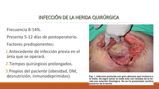 Frecuencia 8-14%.
Presenta 5-12 días de postoperatorio.
Factores predisponentes:
1.Antecedente de infección previa en el
área que se operará.
2.Tiempos quirúrgicos prolongados.
3.Propios del paciente (obesidad, DM,
desnutrición, inmunodeprimidos).
 