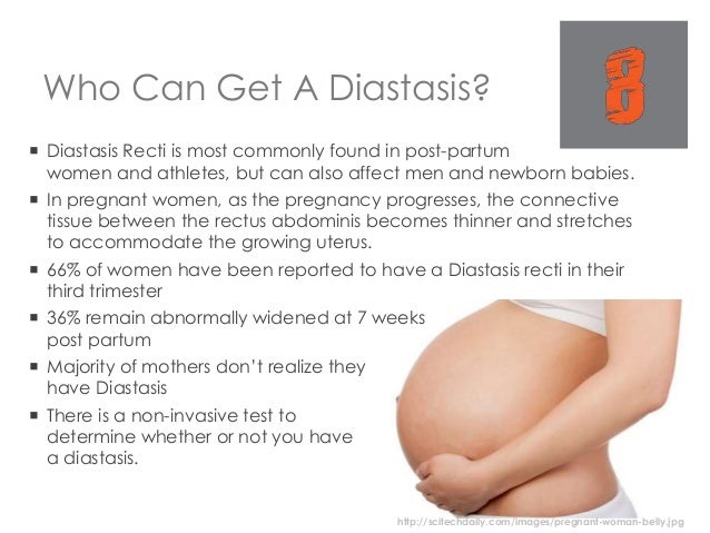 Diastasis - Prevention and Correction Diastasis - Prevention and Correction