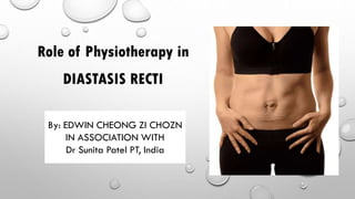 By: EDWIN CHEONG ZI CHOZN
IN ASSOCIATION WITH
Dr Sunita Patel PT, India
Role of Physiotherapy in
DIASTASIS RECTI
 