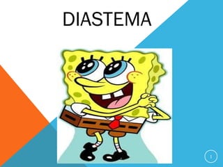 DIASTEMA




           1
 