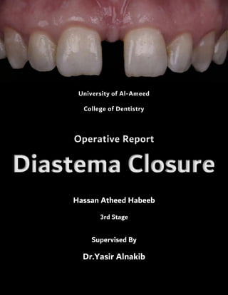 Hassan Atheed Habeeb
3rd Stage
Supervised By
Dr.Yasir Alnakib
Diastema Closure
Operative Report
University of Al-Ameed
College of Dentistry
 