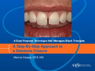 A Dual-Purpose Technique that Manages Black Triangles

A Step-By-Step Approach to
a Diastema Closure
Marcos Vargas, DDS, MS
 