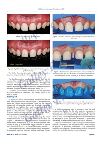 Page 2 of 7
XXXX et al. Medicine and Clinical Science XXX
Med Clin Sci. (2024) Vol 6, Issue XX Page 2 of 7
Galley Proof
Galley Proof
Galley Proof
The dental morphology usually determines the shape and the
volume of the interdental space, which must be filled by a dense
connective tissue covered by oral epithelium to achieve pleasant
esthetics. When resin composite restorations are placed to solve
esthetic problems, the restorative procedure must be designed to
allow the formation of healthy interdental papilla [1,8,9].
This article describes a new modification in matrixing system
to achieve biological, functional, and esthetic result in the
anterior region.
Case Report
A 25-year-old female concerned with the space between her
front teeth presented to our practice (Figure 1). The patient also
stated that a friend had their diastema closed, but that a black
space was left between the buildups and the gingiva (i.e., black
triangles). It was explained that a black triangle results from the
architecture of the bone and the distance between the contact
points and the crest of the bone [1]. The option of closing the
diastema with resin composites was presented to the patient,
who agreed to the proposed treatment plan. (Figure 2)
Tooth shade should be obtained by comparing the center
middle-third of the tooth against the middle of the shade tab
(Figure 2). An enamel-like opacity material is usually selected
when closing diastemas up to 2 mm. Larger diastemas may
require layering of a dentin-like opacity material to prevent
show-through, followed by an enamel-like opacity material.
Tooth preparation is not required when closing a diastema.
In situations where the teeth are slightly misaligned (Figure
3), a slight recontouring may be necessary when the teeth
are positioned facially. On the other hand, no preparation is
necessary when the teeth are lingually positioned. Roughening
of the enamel is recommended only when self-etch adhesives
are to be used. Following tooth preparation, the enamel surface
of both teeth is etched for at least 30 seconds (Figures 5&6),
after which the adhesive bonding agent is placed and cured.
Composite resin materials for this technique must demonstrate
handling characteristics that enable placement without slumping
or sticking to placement instruments. Few commercially
available resin composites demonstrate the handling characters-
tics for this particular diastema closure technique.
Figure 1. Preoperative intraoral image.
Figure 2. Digital Smile Design very important in these cases used as
guide in all steps.
The Golden Proportion (proportion of 1.618:1.0:0.618) used to
determine adequate distribution of the spaces between teeth.
Figure 3. To better control the gingival margin, a split dam technique
was used.
Figure 4. No preparation of the tooth surface is needed other than
passing a coarse disc over the enamel to only remove the aprismatic
layer, and provide a clean substrate for the adhesive procedures
Figure 5. The enamel surface was treated with 37% orthophosphoric
acid for 20 seconds, followed by rinsing thoroughly with water.
 