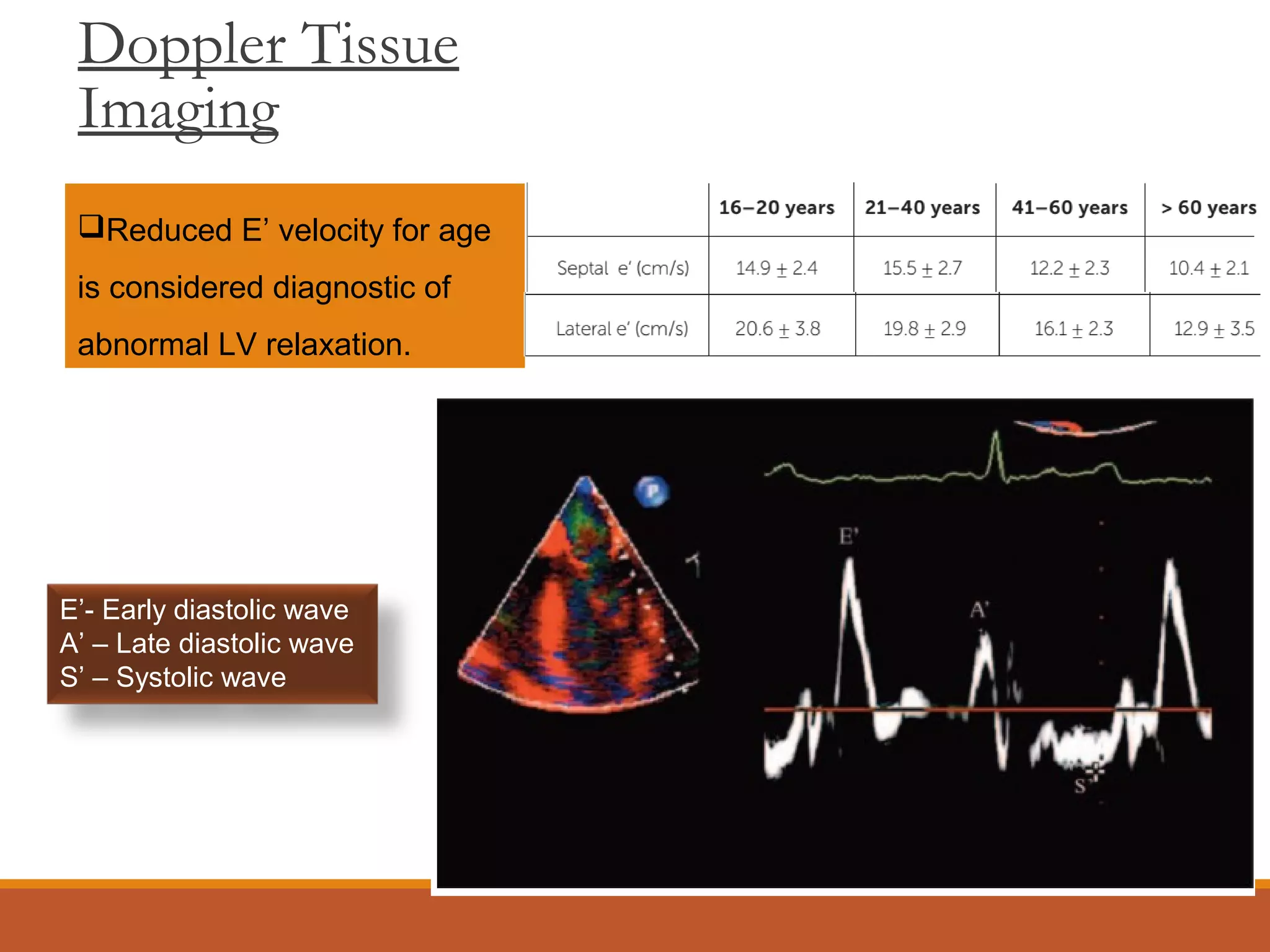 Doppler Tissue
Imaging
Reduced E’ velocity for age
is considered diagnostic of
abnormal LV relaxation.
E’- Early diastolic wave
A’ – Late diastolic wave
S’ – Systolic wave
 