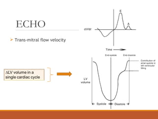 ECHO
 Trans-mitral flow velocity
 