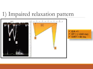 1) Impaired relaxation pattern
 E/A <1
 DT ↑ ( >240 ms)
 IVRT > 90 ms.
 