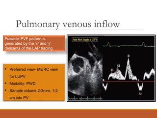 Pulmonary venous inflow
 Preferred view- ME 4C view
for LUPV
 Modality- PWD
 Sample volume 2-3mm, 1-2
cm into PV
Pulsatile PVF pattern is
generated by the ‘x’ and ‘y’
descents of the LAP tracing
 
