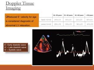 Doppler Tissue
Imaging
Reduced E’ velocity for age
is considered diagnostic of
abnormal LV relaxation.
E’- Early diastolic wave
A’ – Late diastolic wave
S’ – Systolic wave
 