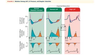 Comprehensive Evaluation of Left Ventricular Diastolic Dysfunction ...