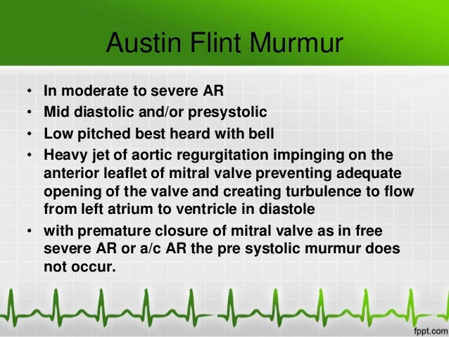 Diastolic Murmurs
