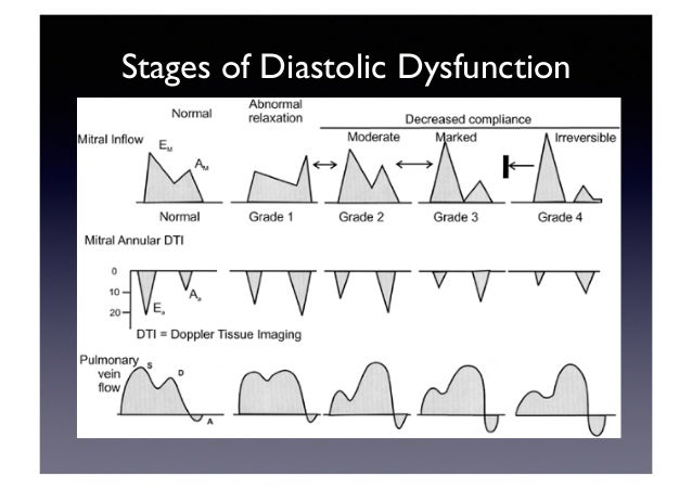 Echocardiographic Evaluation of LV Diastolic Function