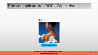 Atualizações em: www.slideshare.net/savagner -
e-mail: vagnersarj@gmail.com
6
Tipos de aplicadores DOC - Capacitivo
Placas capacitivas
 