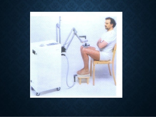 Diatermia onda corta y su mantenimiento