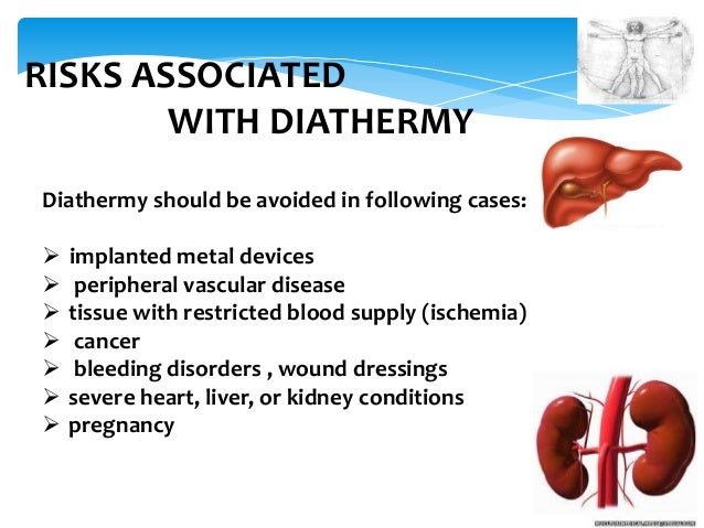 Diathermy Diathermy