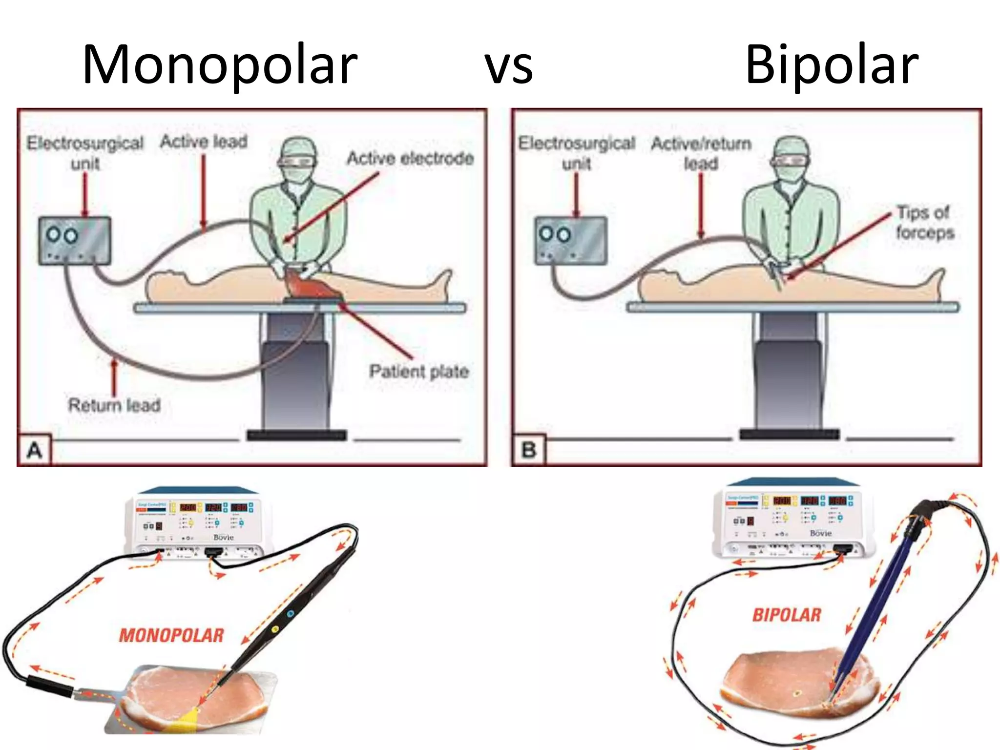 Diathermy in surgery PPT