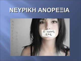 ΝΕΥΡΙΚΗ ΑΝΟΡΕΞΙΑΝΕΥΡΙΚΗ ΑΝΟΡΕΞΙΑ
 
