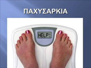 ΠΑΧΥΣΑΡΚΙΑΠΑΧΥΣΑΡΚΙΑ
 