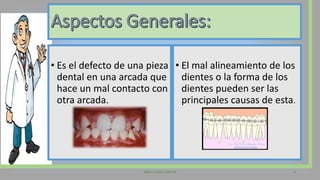 • Es el defecto de una pieza
dental en una arcada que
hace un mal contacto con
otra arcada.
• El mal alineamiento de los
dientes o la forma de los
dientes pueden ser las
principales causas de esta.
Valeria Díaz Cabrera 3
 