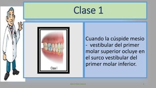 Cuando la cúspide mesio
- vestibular del primer
molar superior ocluye en
el surco vestibular del
primer molar inferior.
Valeria Díaz Cabrera 6
Clase 1
 