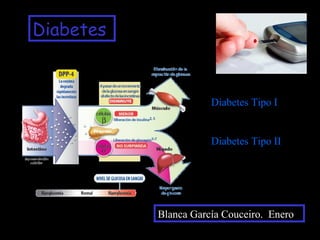 Diabetes

Diabetes Tipo I

Diabetes Tipo II

Blanca García Couceiro. Enero

 