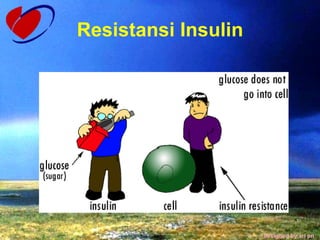 Resistansi Insulin 