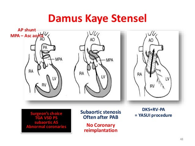 surgical-approach-of-cyanotic-congenital-heart-disease