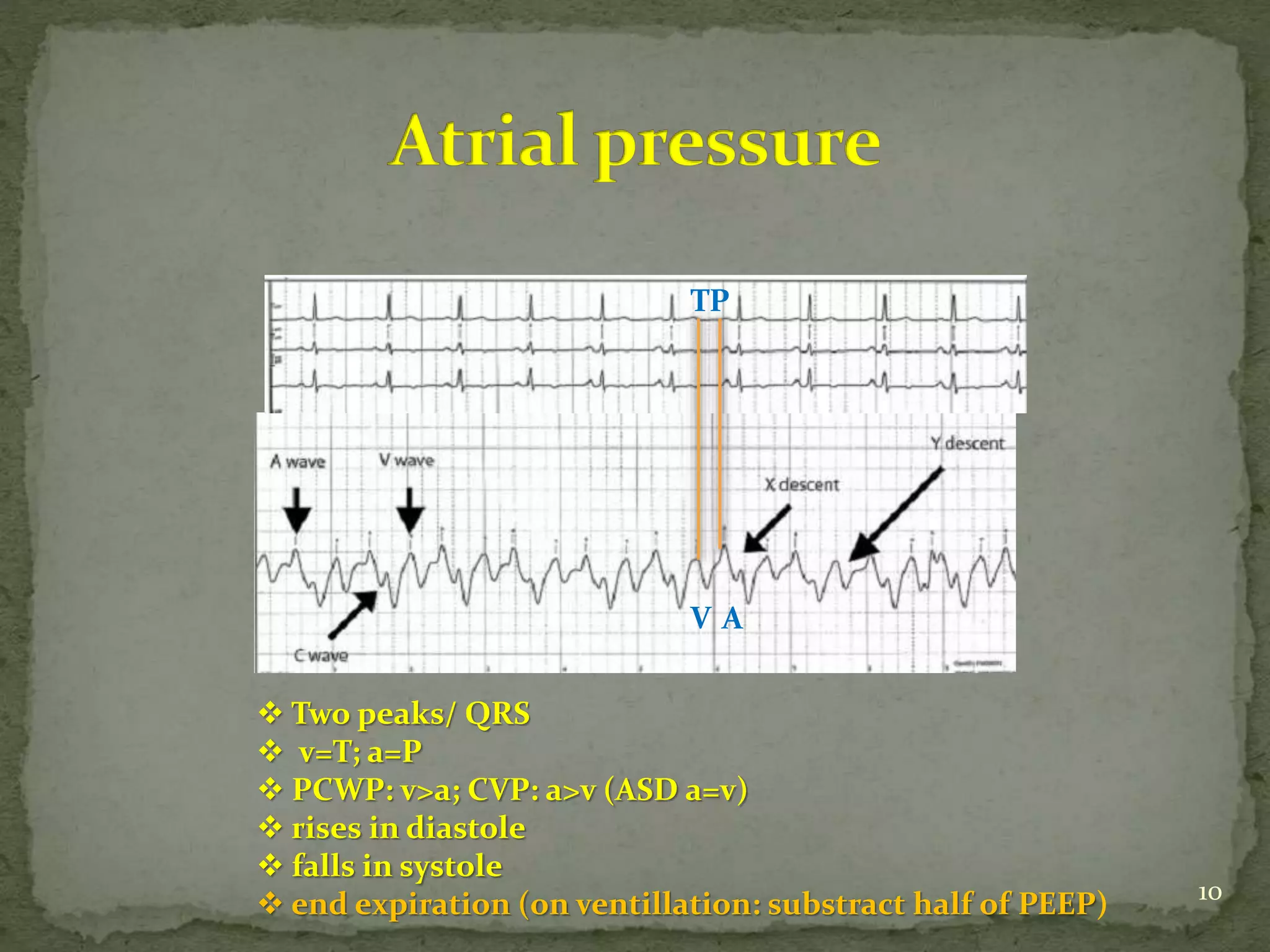 TP
V A
 Two peaks/ QRS
 v=T; a=P
 PCWP: v>a; CVP: a>v (ASD a=v)
 rises in diastole
 falls in systole
 end expiration (on ventillation: substract half of PEEP) 10
 