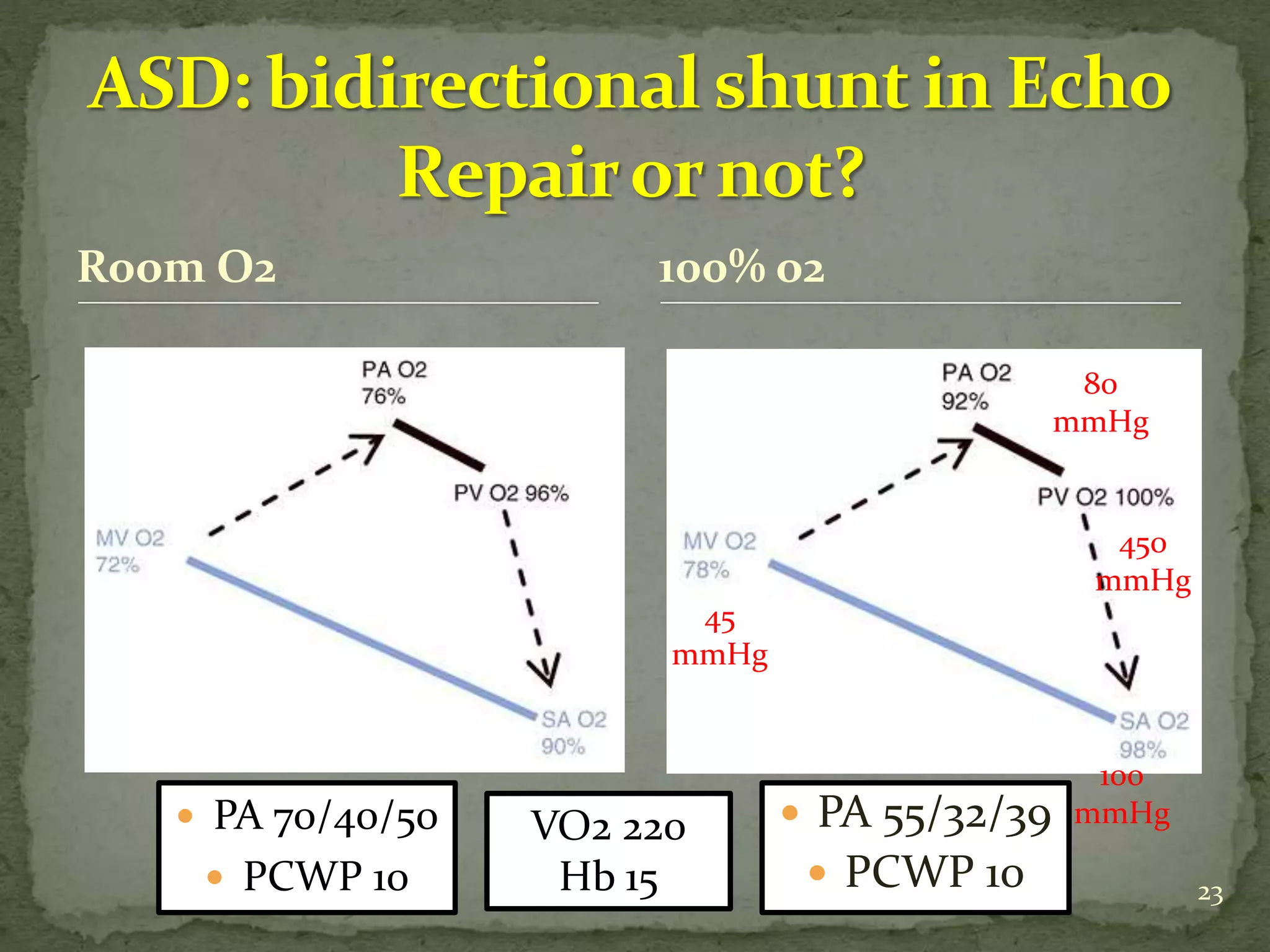 23
Room O2
 PA 70/40/50
 PCWP 10
100% o2
VO2 220
Hb 15
45
mmHg
80
mmHg
450
mmHg
100
mmHg PA 55/32/39
 PCWP 10
 