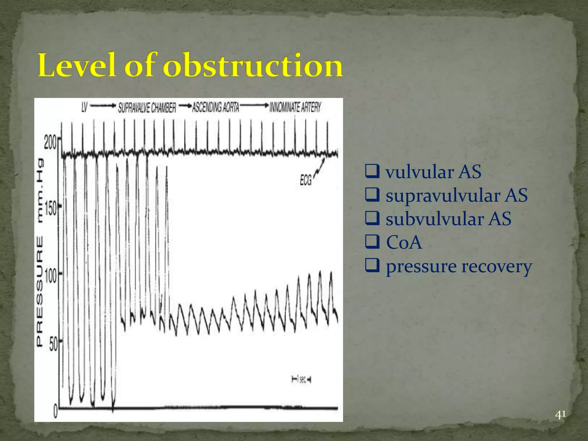 41
 vulvular AS
 supravulvular AS
 subvulvular AS
 CoA
 pressure recovery
 