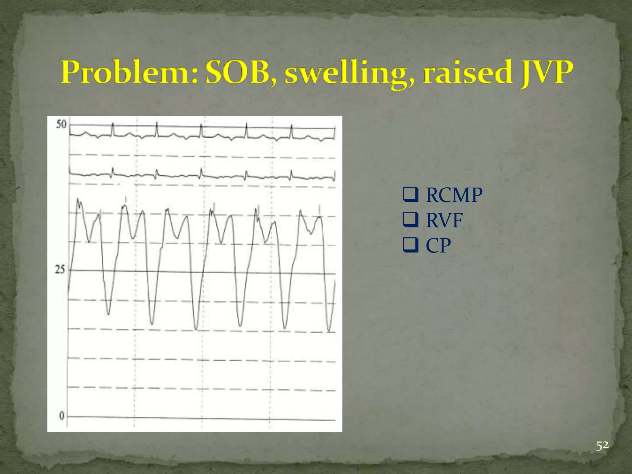 52
 RCMP
 RVF
 CP
 