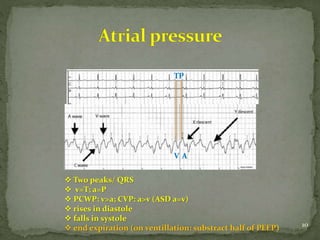 interpretation of hemodynamic data | PPTX