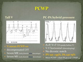 Normal Pcwp Rhc interpretation of hemodynamic data | PPTX