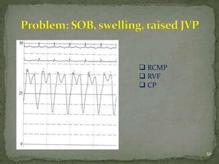 Mrf Rcpm interpretation of hemodynamic data | PPTX