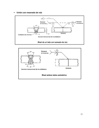 77
 Unión con resanado de raíz
 