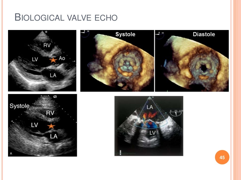 PROSTHETIC HEART VALVES