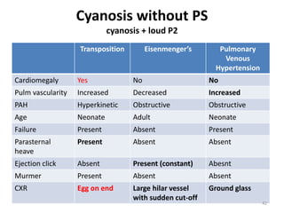 Dibu's approach to congenital heart disease | PPTX
