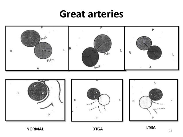Dibu's approach to congenital heart disease